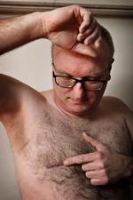 Andreas Bernth, 49 år, blev opereret for brystkræft for et år siden.  