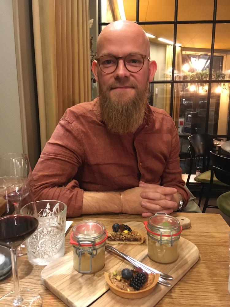 Martin Bastholm Pedersen opdagede sidste år, at et mistænkeligt sår i tindingen var hudkræft.  Foto: Privat