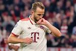 Hvis du f.eks. ser Harry Kane og Bayern München spille Champions League-bold gennem YouSee, må du have pungen op igen.  Foto: Alexandra Beier/Ritzau Scanpix