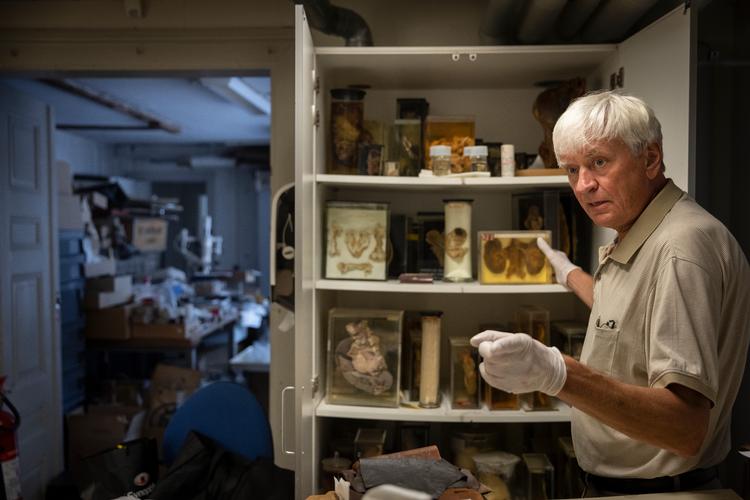 Medicinsk Museion har dele af menneskekroppe tilbage fra 1780’erne, som primært blev fremstillet til undervisning af lægestuderende. Når de ifølge Ion Meyer fortsat skal bevares, er det, fordi vi er nødt til at dokumentere vores fortid for at forstå den.  Foto: Mads Nissen