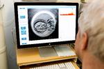 Der blev i 2023 gennemført knap 3.000 behandlinger herhjemme med donoræg, hvilket ifølge Sundhedsdatastyrelsen er en 10-dobling på 10 år. Foto: Gregers Tycho