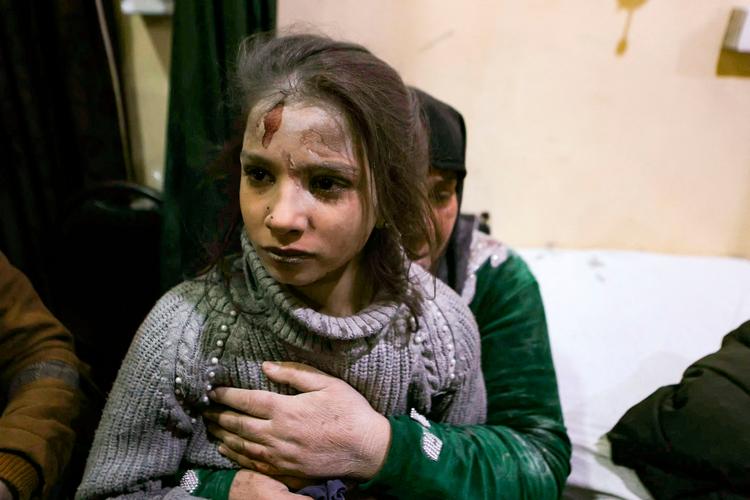 En pige venter på at få behandling efter at være kommet til skade ifm kampe i Idlib. Foto: Aaref Watad/Ritzau Scanpix