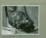 Hovedet af en mumie, som egyptologen Valdemar Schmidt pakkede ud foran publikum. Kroppen blev lagt i kisten, som er udstillet på Glyptoteket, men hovedet blev sendt til Anatomisk Museum, det nuværende Medicinsk Museion. Her oplyser man, at man har en »genstand registreret som hovedet fra en mumie«.  Foto: Medicinsk Museion