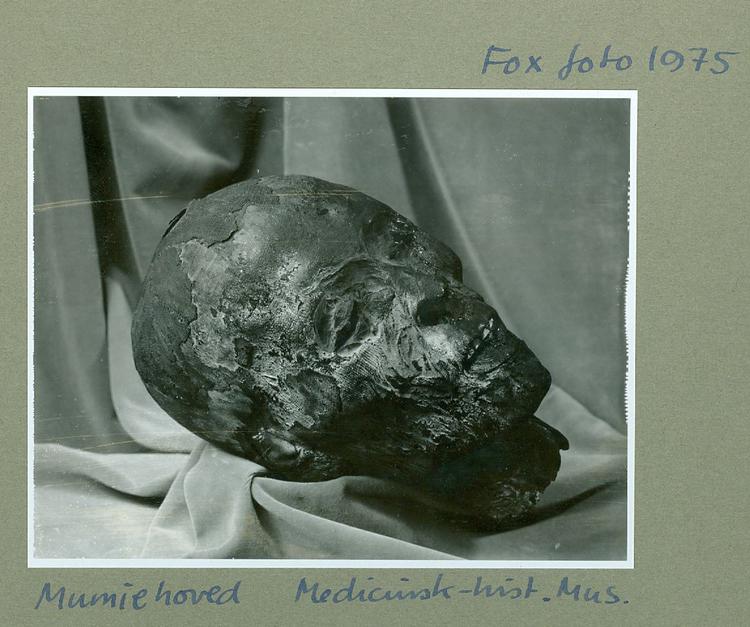 Hovedet af en mumie, som egyptologen Valdemar Schmidt pakkede ud foran publikum. Kroppen blev lagt i kisten, som er udstillet på Glyptoteket, men hovedet blev sendt til Anatomisk Museum, det nuværende Medicinsk Museion. Her oplyser man, at man har en »genstand registreret som hovedet fra en mumie«.  Foto: Medicinsk Museion