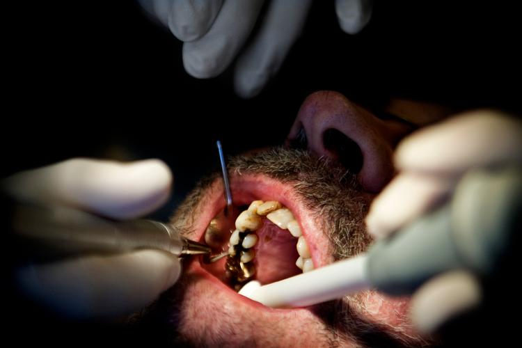 Patienternes egenbetaling kan være skævt fordelt, meddeler Statsrevisorerne mandag på sin hjemmeside i kritik af Indenrigs- og Sundhedsministeriets reduktion af tilskuddet til behandling. Arkivfoto:  Mads Nissen