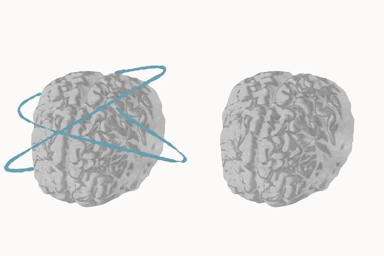 Trin for trin: Sådan afklarer fagfolk, om voksne har adhd