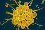 Denne bakterie Neisseria gonorrhoeae skal man ikke ønske sig i sine kønsorganer, for så får man kønssygdommen gonorré, som rammer 80 millioner mennesker om året. Foto: NIAID