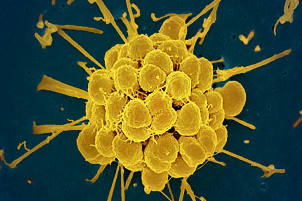 Denne bakterie Neisseria gonorrhoeae skal man ikke ønske sig i sine kønsorganer, for så får man kønssygdommen gonorré, som rammer 80 millioner mennesker om året. Foto: NIAID