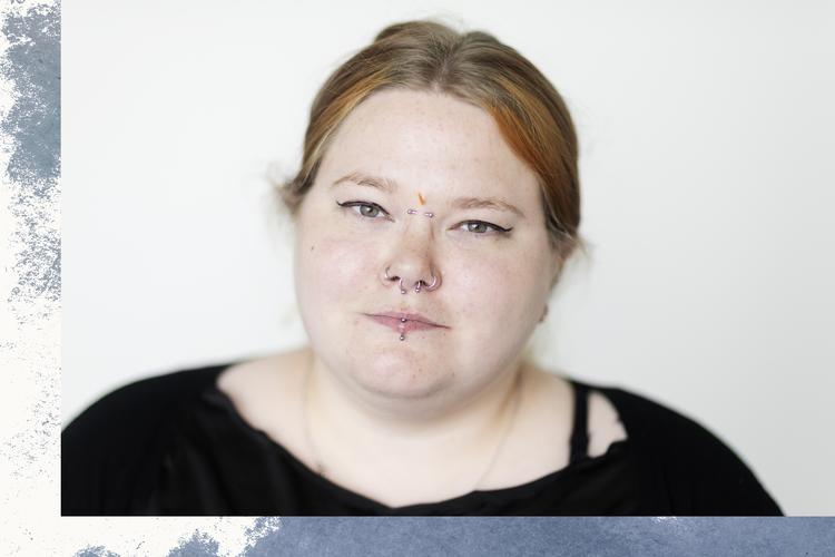 Charlotte Larsen har akupunkturnåle i panden, fordi det hjælper hende med at falde til ro.  
