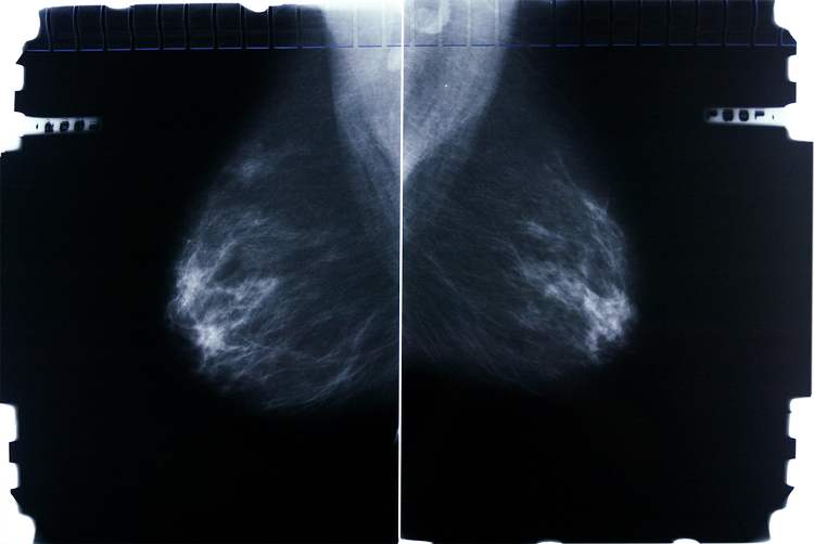 Foto: Miriam Dalsgaard