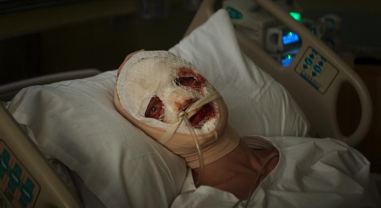 Alt håb synes ude for det oscarnominerede stjernefrø (Thomas Rhys Harries) i 'Clayface'. Men det er inden genopretningen af hans skønhed - og inden de dramatiske mutationer.  Foto: Warner Bros