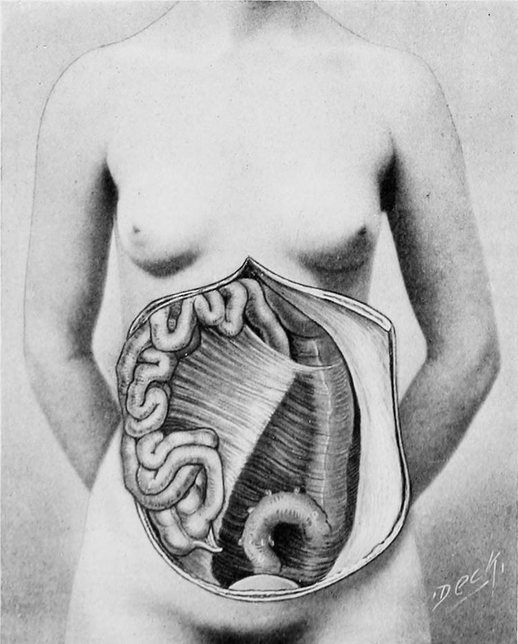 Organ nr. 79. Hils på dit nye organ. Det hedder krøs og er det ophæng i kroppen, der holder vores mavesæk og tarme på plads ved at hæfte det til bugvæggen. Det er det stribede og riflede ved siden af tarmene, der er krøs.
 