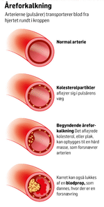 WEB-Kolesterol-expl310pxgif