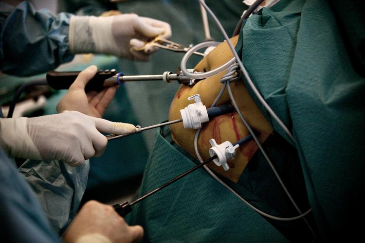 Sundhedsstyrelsen vil give flere overvægtige mulighed for at få en fedmeoperation (arkivfoto) 