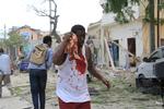 Somalia Blast