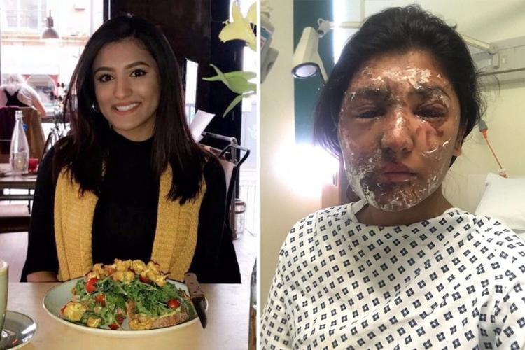 21-årige Resham Khan er et af ofrene for de mange syreangreb i London. Nu vil regeringen undersøge mulighederne for livstidsdomme i de værste sager.  