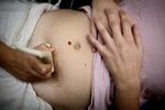 Aborter. B3-vitamin kan muligvis forhindre ufrivillige aborter og fosterskader, men endnu er det kun påvist i mus. Derfor bør kvinder ikke tage ekstra B3 på baggrund af den nye australske forskning, advarer overlæge. FOTO: ASTRID DALUM
   