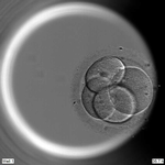 Denne klump af fire celler er det første spæde skridt på en menneskeudvikling, som de brutiske forskere har studeret i en petriskål. Med den banebrydende genteknologi CRISPR-Cas9 har de fundet et gen, som er centralt for, at et præembryo udvikler sig normalt. Hvis man slår genet ud kollapser den embryonale udvikling. Foto: Francis Crick Institute 