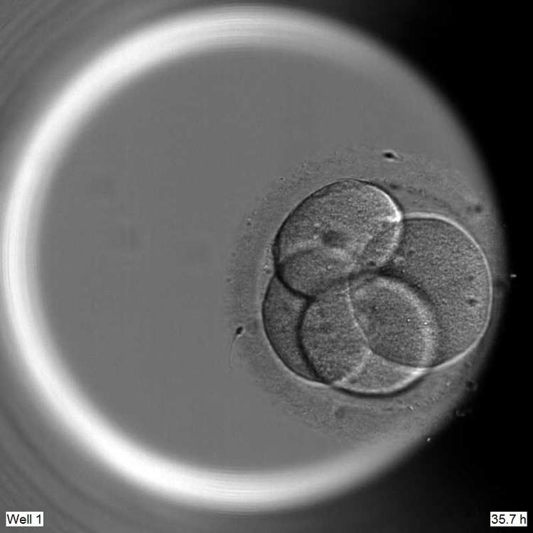 Denne klump af fire celler er det første spæde skridt på en menneskeudvikling, som de brutiske forskere har studeret i en petriskål. Med den banebrydende genteknologi CRISPR-Cas9 har de fundet et gen, som er centralt for, at et præembryo udvikler sig normalt. Hvis man slår genet ud kollapser den embryonale udvikling. Foto: Francis Crick Institute 