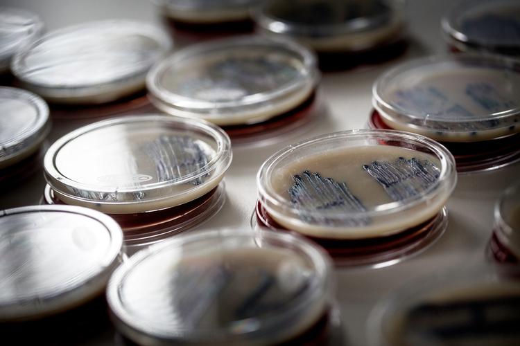 Det er vigtigt at skære ned på forbruget af penicillin for at nedsætte risikoen for udviklingen af multiresistente bakterier.  Peter Klint/POLFOTO