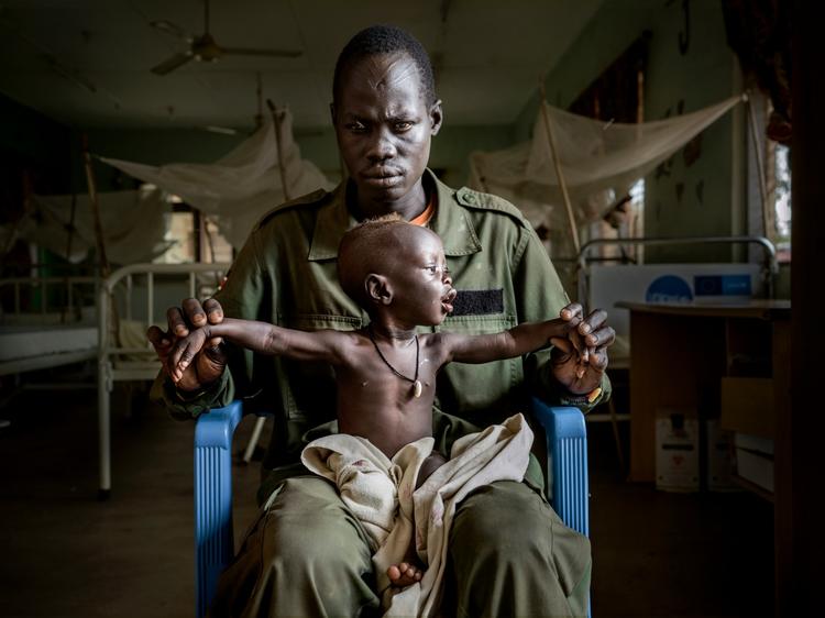 Peter Ksamy Jsiu er soldat i Sydsudans regeringshær og enlig far til Athian på 11 måneder. De er på hospitalet i hovedstaden Juba, fordi den lille dreng er underernæret.  
