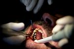 Behandling i udlandet kan barbere en tredjedel af tandlægeregningen. Men man risikerer overbehandling, siger Tandlægeforeningen.  Mads Nissen/POLFOTO