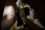 ARKIVFOTO. Screening for modermærkekræft på Hudklinikken Østerbro ved hudlæge Johan Poulsen.    