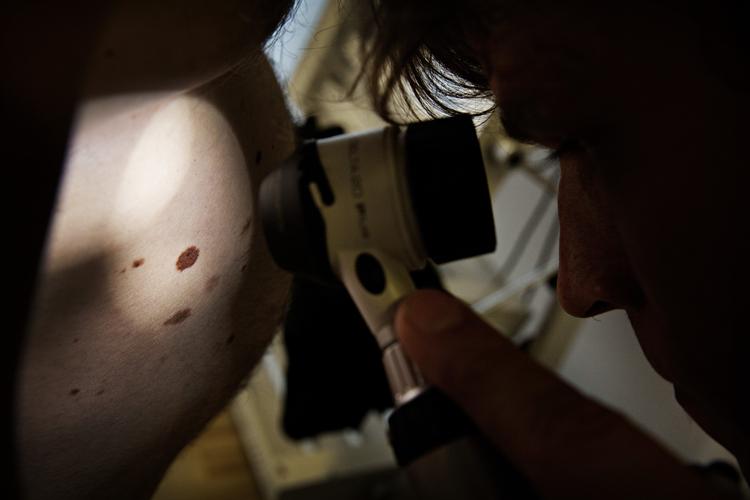 ARKIVFOTO. Screening for modermærkekræft på Hudklinikken Østerbro ved hudlæge Johan Poulsen.    