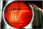 Bakterier, der ikke længere kan slås ned med antibiotika, er lægernes dommedagsmareridt. Alligevel bruges antibiotika i stort omfang i strid med alle anbefalinger, blandt andet i landsbruget i Asien og Sydamerika. 