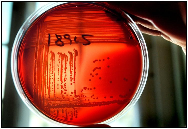 Bakterier, der ikke længere kan slås ned med antibiotika, er lægernes dommedagsmareridt. Alligevel bruges antibiotika i stort omfang i strid med alle anbefalinger, blandt andet i landsbruget i Asien og Sydamerika. 