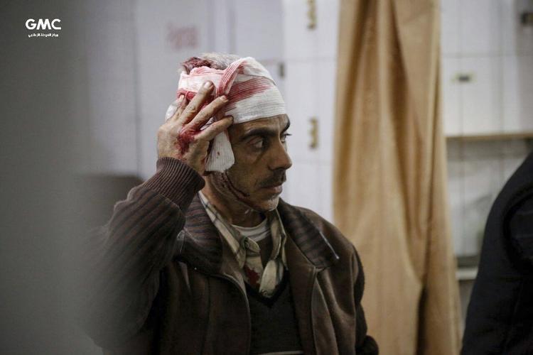 En såret mand behandles for sine skader på hospitalet i Ghouta. /AP