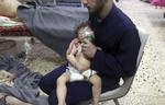 En frivillig holder en iltmaske over et barns ansigt på et hospital, efter et giftgasangreb ramte den syriske by Douma nær hovedstaden, Damaskus, i weekenden. Mindst 42 mennesker døde. /AP