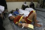 Sårede palæstinensiske børn ligger på madrasser spredt på gulvet på et hospital i Gaza efter et israelsk angreb 1. august 2014. Eyad Baba/AP
