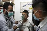 Civile behandles på sygehuset i Aleppo efter at de angiveligt er blevet udsat for et giftgasangreb. Foto: /AP