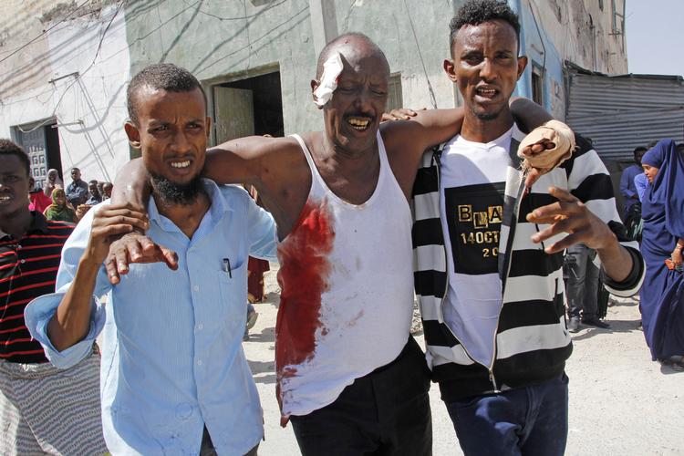 Mindst 15 er døde i angrebet. Flere andre slap med kvæstelser. Foto: Farah Abdi Warsameh/AP