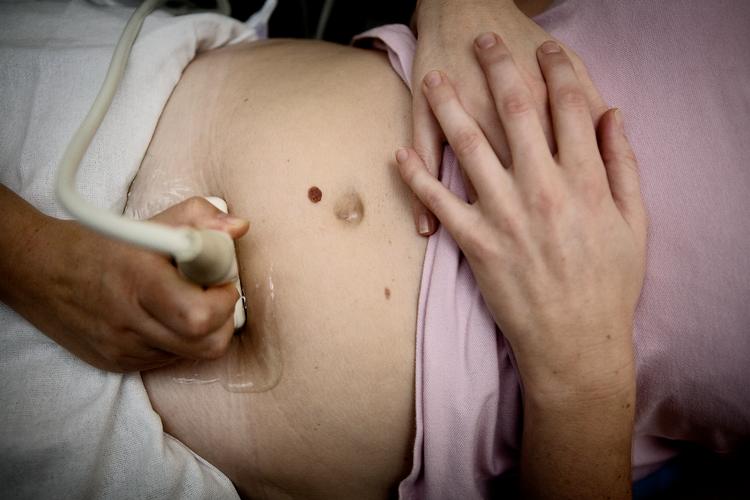 Overvågning af misdannelser hos fostre og nyfødte er vigtig, fordi det kan være en advarsel om, at der er ting i vores miljø eller livsstil, der påvirker vores sundhed. Arkivfoto. Foto: Astrid Dalum/POLFOTO