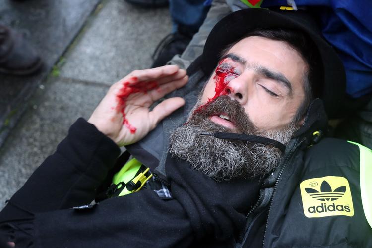 
Jerome Rodrigues her fanget lige efter hændelsen.  Foto: Zakaria Abdelkafi/Ritzau Scanpix