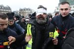 
 Jérôme Rodriques risikerer at miste sit ene øje. Han er blevet et symbol på de mange, som er ofre for flash balls og chokgranater. Myndighederne venter nye sammenstød i dag.   . (Photo by Zakaria ABDELKAFI / AFP)
   Foto: Zakaria Abdelkafi/Ritzau Scanpix