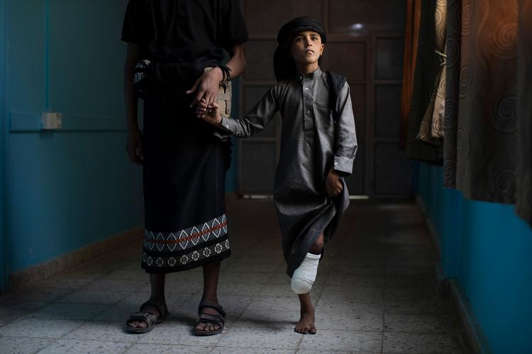 Saleh Raken er en af de mange yemenitter, der er blevet alvorligt kvæstet efter nærkontakt med en landmine. Der menes at ligge op mod en million landminer i jorden i Yemen, og det kan plage landet i årevis. 
   Foto: Tyler Hicks/Ritzau Scanpix