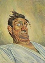 ‘Akrobaten Schulz’, som Albert Birkle portrætterede i 1921, kan trække sine ansigtstræk af led. Foto: The George Economou Collection © DACS, London 2018