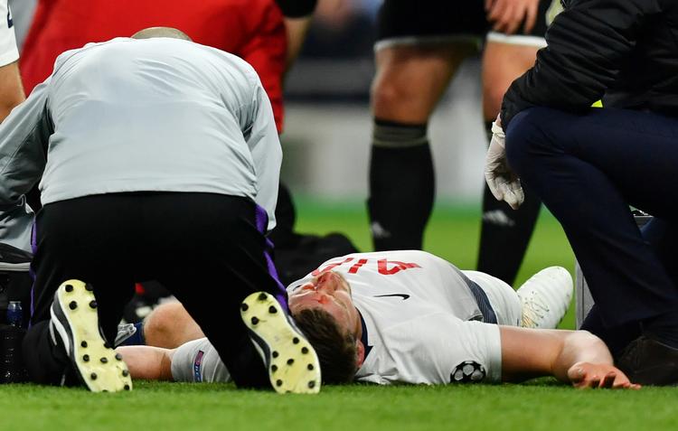 Tottenham-forsvareren Jan Vertonghen behandles efter sit sammenstød med holdkammeraten Toby Alderweireld.
   Foto: Dylan Martinez/Ritzau Scanpix