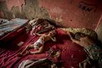 
    Den to år gamle Anailin (tv) fra Isla de Toas i Venezuela lider af alvorlig underernæring.  Foto: Meridith Kohut/Ritzau Scanpix