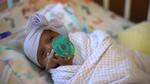 Saybie vejede kun 245 gram, da hun blev født efter 23 ugers graviditet - normalen er 40 uger.  Foto: Ho/Ritzau Scanpix