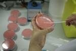 Statens Serum Institut arbejder tæt sammen med Fødevarestyrelsen og Fødevareinstituttet DTU om at prøve at finde smittekilden til salmonellaen og stoppe udbruddet. De ramte personer har ikke været ude at rejse, før de blev syge. De kender ikke hinanden og har ikke deltaget i fælles begivenheder.
Så mistanken retter sig mod, at de er blevet syge efter at have spist den samme fødevare. Foto: Finn Frandsen/POLFOTO
