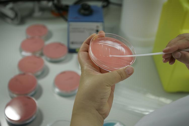 Statens Serum Institut arbejder tæt sammen med Fødevarestyrelsen og Fødevareinstituttet DTU om at prøve at finde smittekilden til salmonellaen og stoppe udbruddet. De ramte personer har ikke været ude at rejse, før de blev syge. De kender ikke hinanden og har ikke deltaget i fælles begivenheder.
Så mistanken retter sig mod, at de er blevet syge efter at have spist den samme fødevare. Foto: Finn Frandsen/POLFOTO