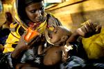 200 millioner børn er fejlernærede, anslår Unicef. På billedet er otte måneder gamle Wilo Abshir fra Somalia i en flygtningelejr i Kenya i 2004. Han fik højenergimælk for at kunne overleve. Arkivfoto.  Foto: Peter Hove Olesen/POLFOTO
