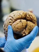 
    Professor og hjerneforsker Bente Pakkenberg viser rundt i hjernebanken på Bispebjerg Hospital. Her opbevares og forskes i hjerner doneret af mennesker. Hjerne, forskning.
   Arkivfoto Lærke Posselt