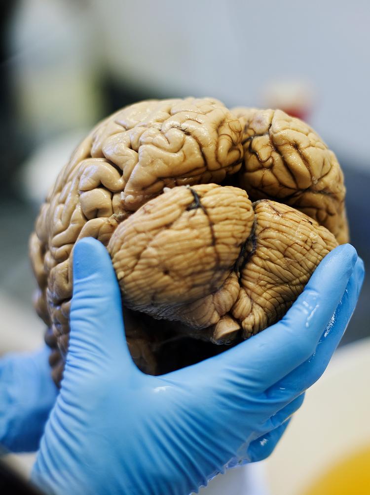 
    Professor og hjerneforsker Bente Pakkenberg viser rundt i hjernebanken på Bispebjerg Hospital. Her opbevares og forskes i hjerner doneret af mennesker. Hjerne, forskning.
   Arkivfoto Lærke Posselt