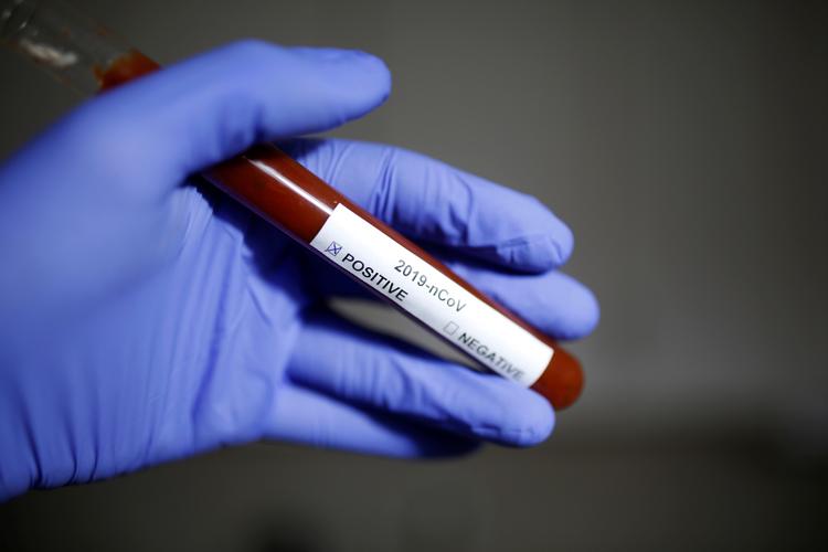 Et par i 60'erne i Illinois er smittet med frygtet virus. Kvinden havde været i Kina, inden hun smittede. Foto: Dado Ruvic/Ritzau Scanpix