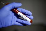 Af hensyn til atleters og testpersonales sikkerhed har Kina midlertidigt afbrudt test for doping, da myndighederne er bange for yderligere spredning af den nye coronavirus. Foto: Dado Ruvic/Ritzau Scanpix
